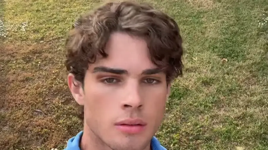 ‘Jestermaxxing’ is bizarre new trend following on from people hitting their faces with hammers