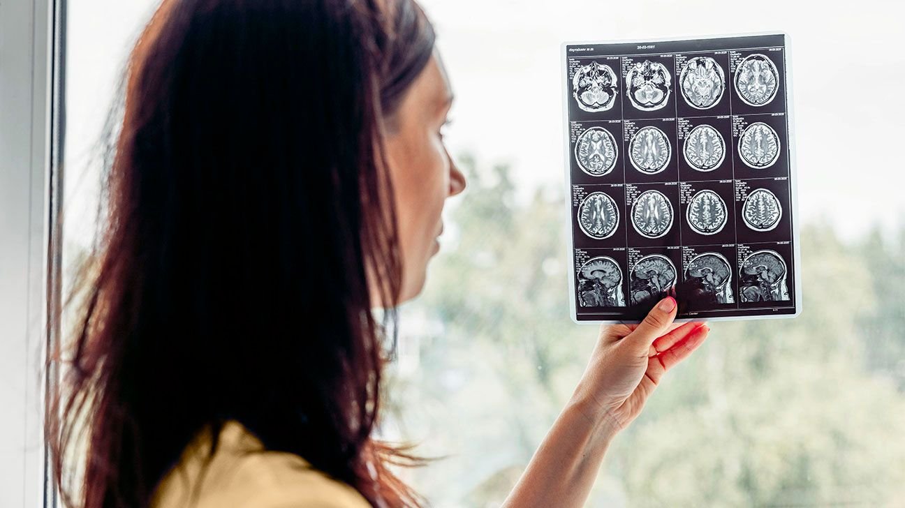 FDA Doesn’t Endorse Leucovorin for Autism, OKs It for Rare Brain Disorder