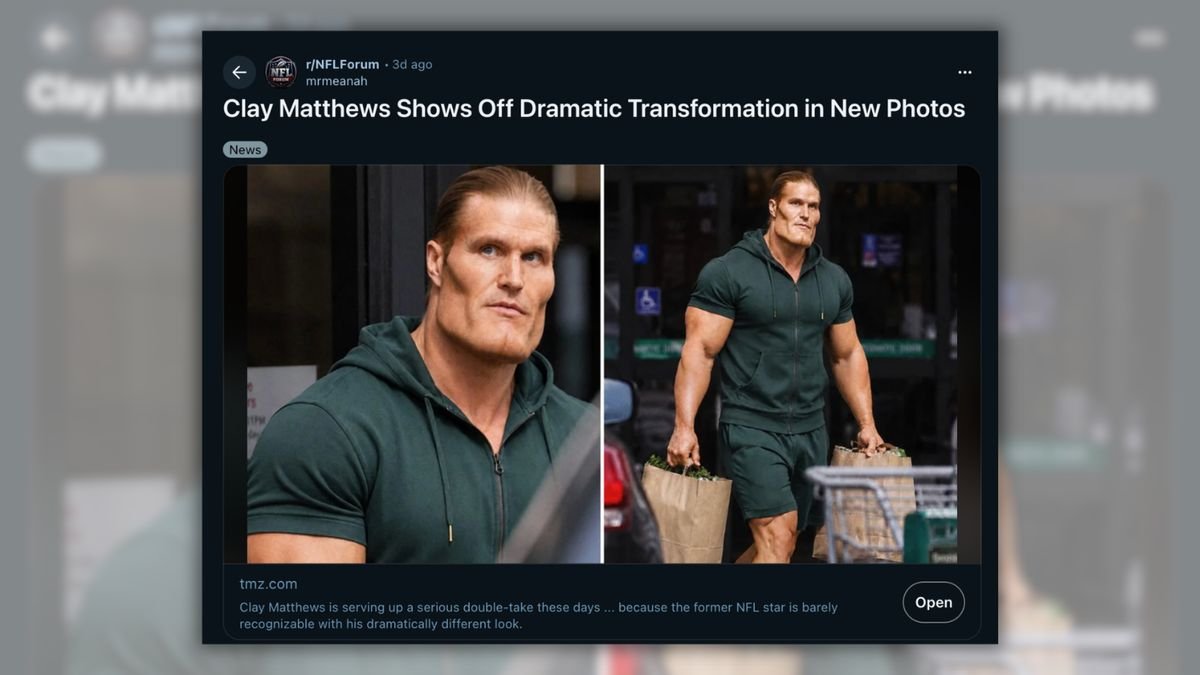 Do images show former NFL star Clay Matthews after plastic surgery?