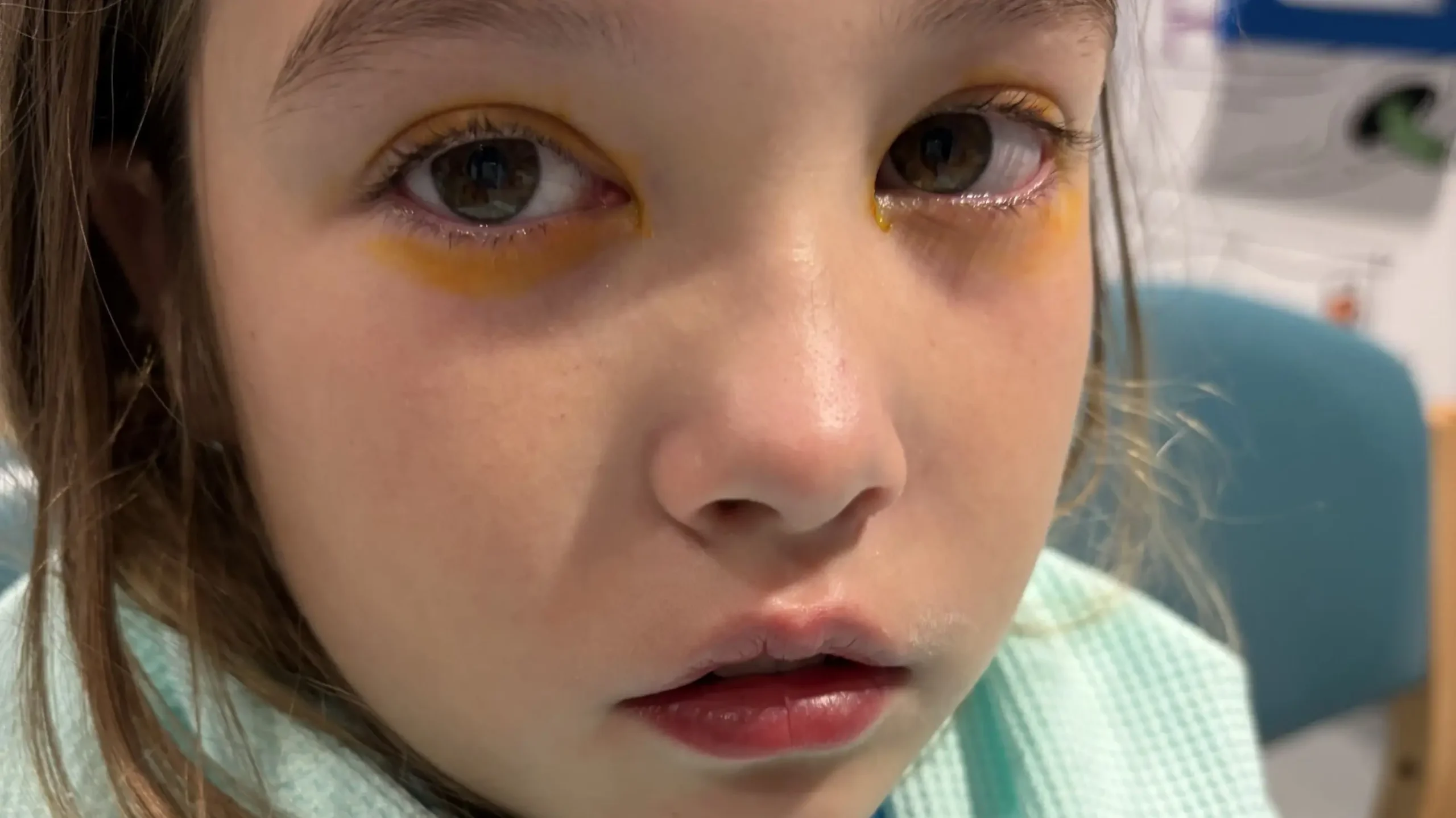 Child, 10, almost blinded after copying YouTube influencer’s ‘life hacks’