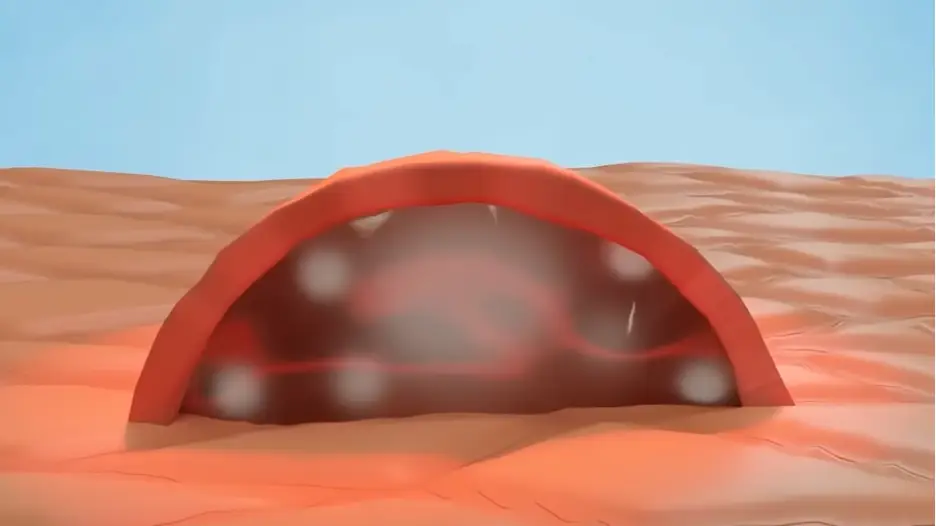 Gruesome simulation shows why you should never pop your blisters