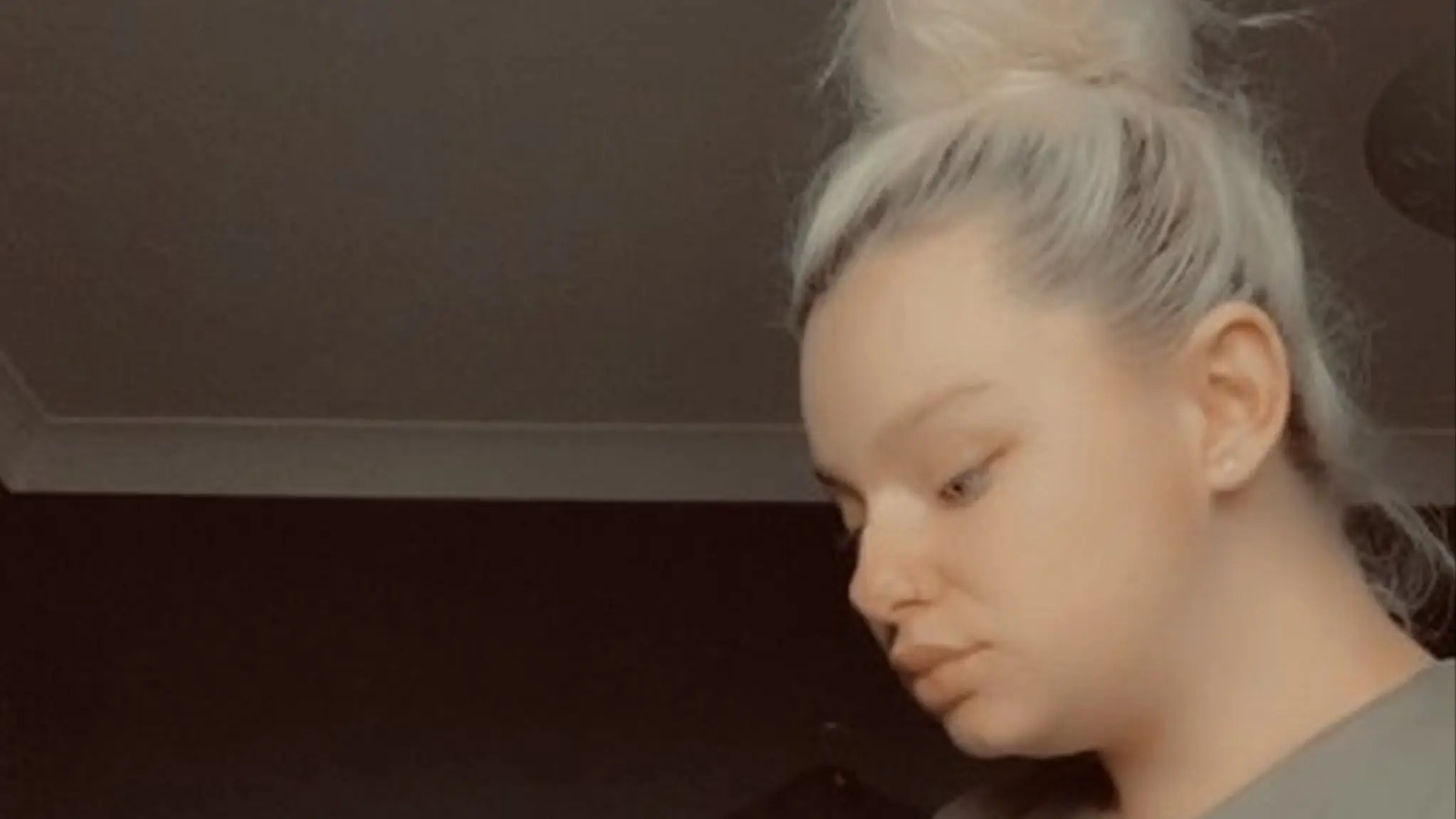 Woman who feared she’d die giving birth left bald with ‘mouldy head’